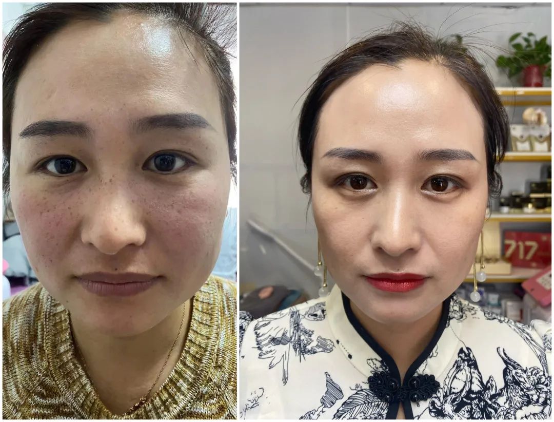 默默717「最美代言人」圆满结束！速戳见证肌肤惊喜蜕变—— – 默默新闻 – 广东默默化妆品有限公司