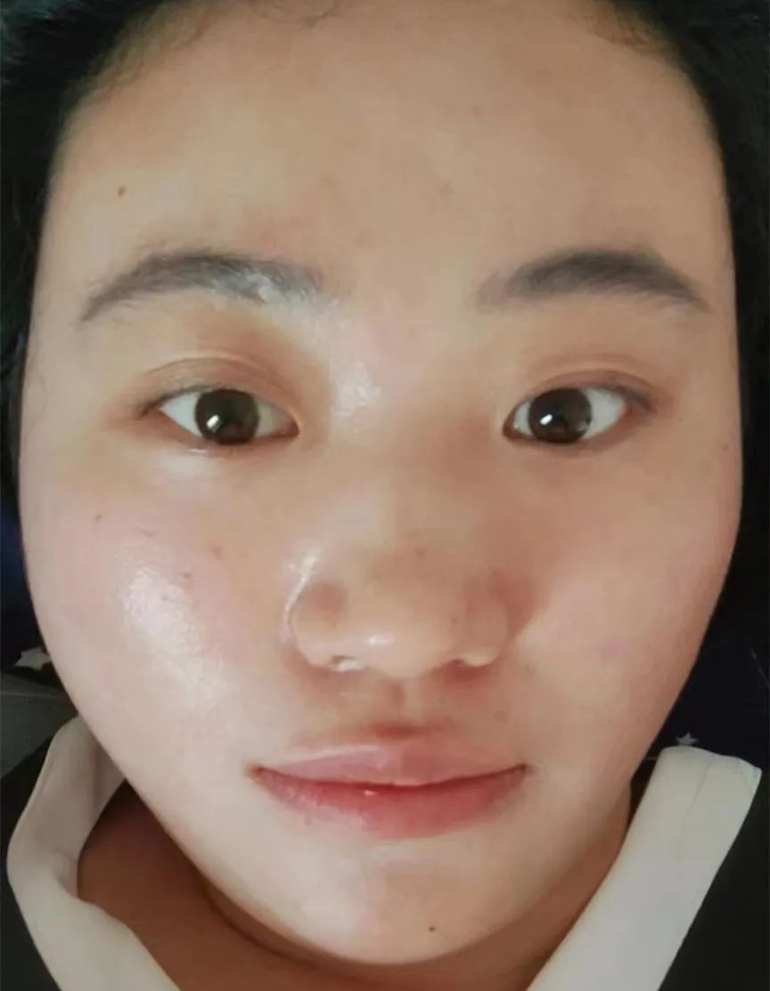 默默717「最美代言人」圆满结束！速戳见证肌肤惊喜蜕变—— – 默默新闻 – 广东默默化妆品有限公司
