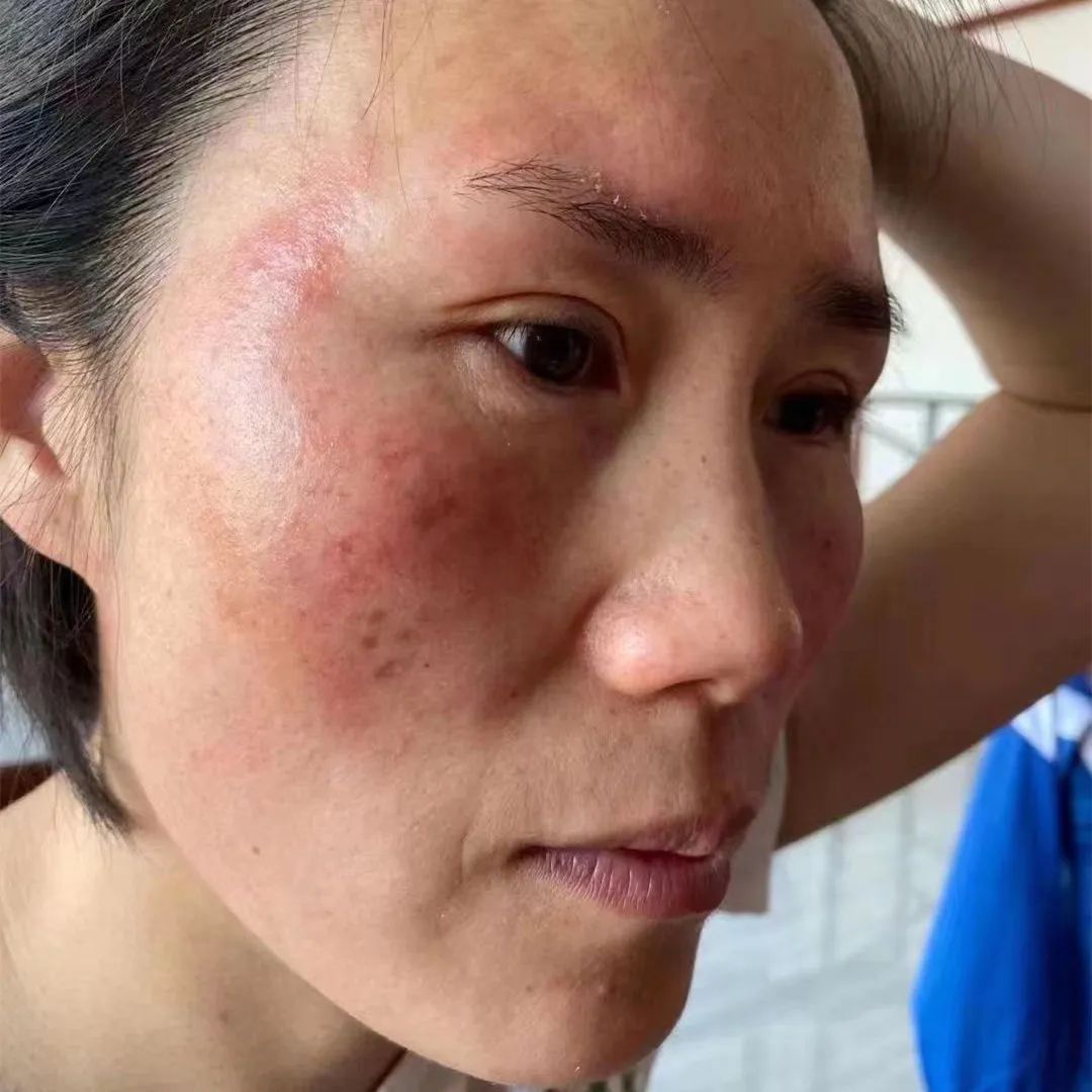 默默717「最美代言人」圆满结束！速戳见证肌肤惊喜蜕变—— – 默默新闻 – 广东默默化妆品有限公司