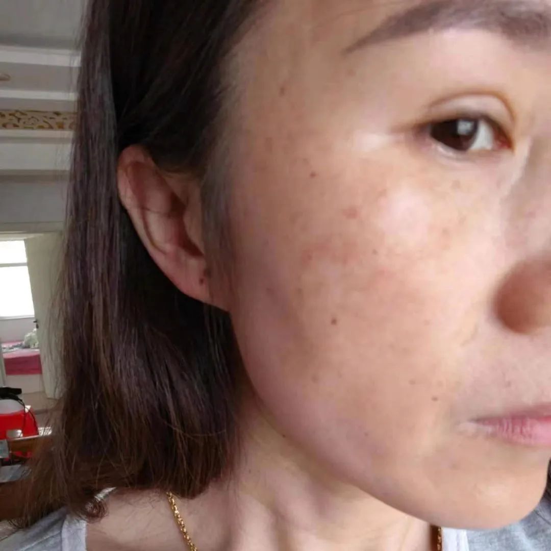 默默717「最美代言人」圆满结束！速戳见证肌肤惊喜蜕变—— – 默默新闻 – 广东默默化妆品有限公司